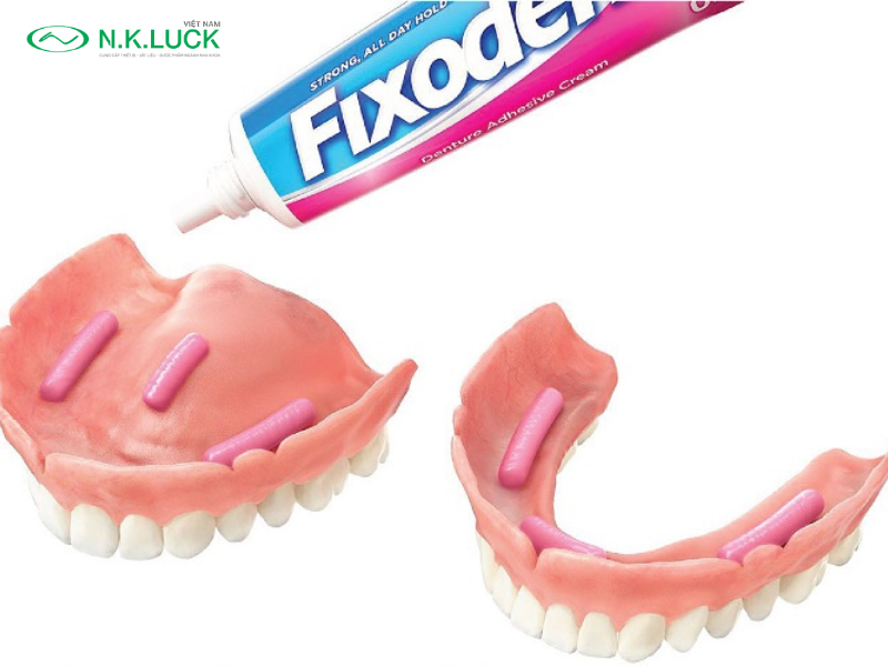 Các loại keo dán răng thông dụng nhất 2024