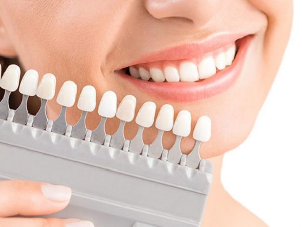 Cần cẩn thận khi sử dụng thuốc tẩy trắng răng đúng cách