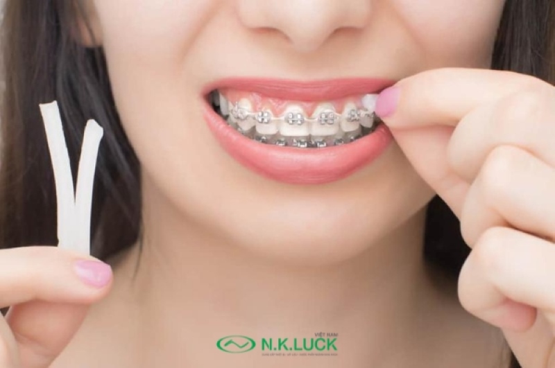 Hướng dẫn sử dụng sáp nha khoa