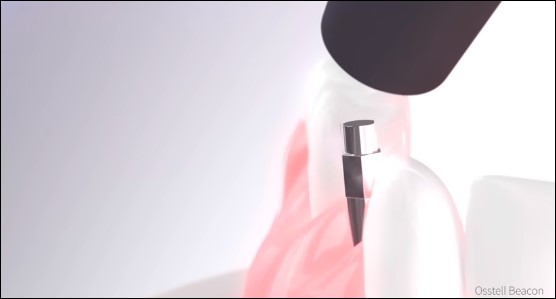 Thiết bị để đo độ ổn định Thiết bị để đo độ ổn định