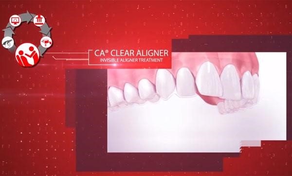 Bước thứ 4: Điều trị