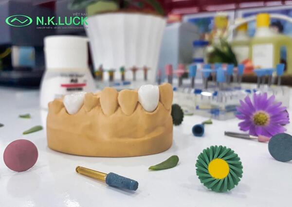 Rất nhiều Khách hàng đã và đang lựa chọn phương pháp này để có một hàm răng trắng bóng và thẩm mỹ hơn