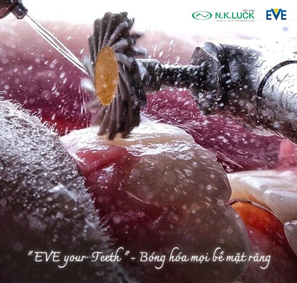 Trong số đó, hệ thống mũi mài & đánh bóng răng/vật liệu phục hình Implant chính là bộ dụng cụ không thể thiếu cho mọi Phòng Khám