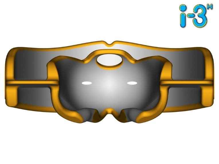myobrace for interceptive i3H trước