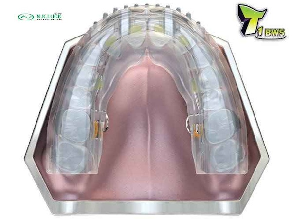 myobrace for teen T1 BWS trước