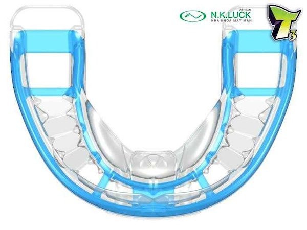 myobrace for teen T3 trước