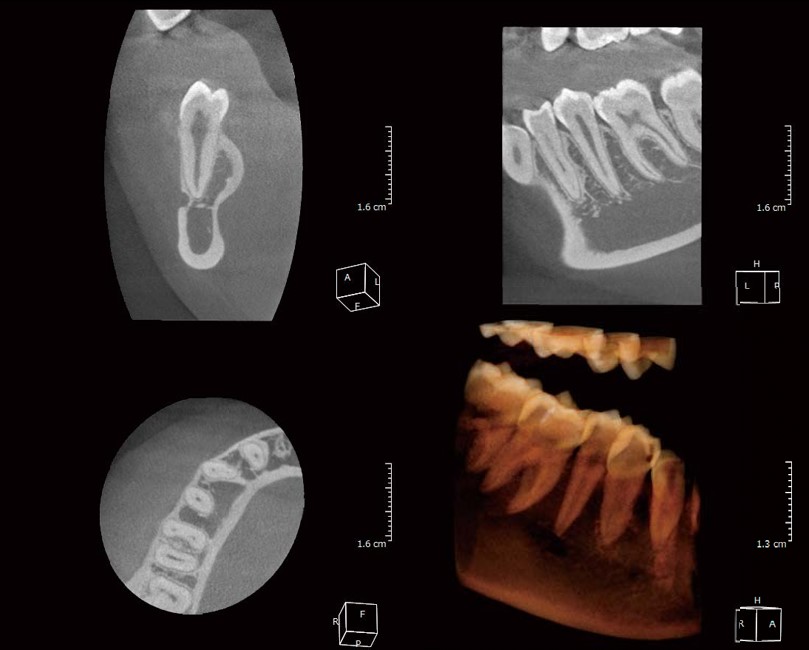 Hình ảnh chụp toàn hàm từ X-ERA Smart