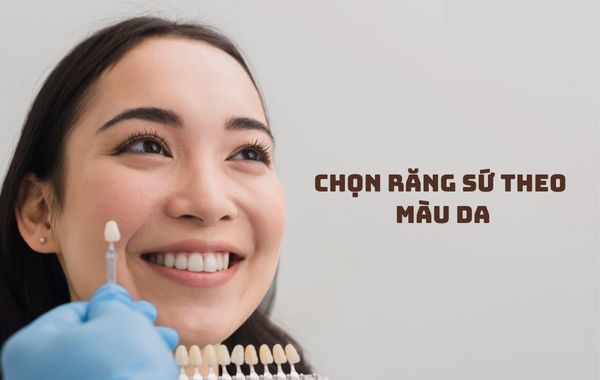 Chọn răng sứ theo màu da là một trong những cách chọn màu răng sứ thẩm mỹ Chọn răng sứ theo màu da là một trong những cách chọn màu răng sứ thẩm mỹ