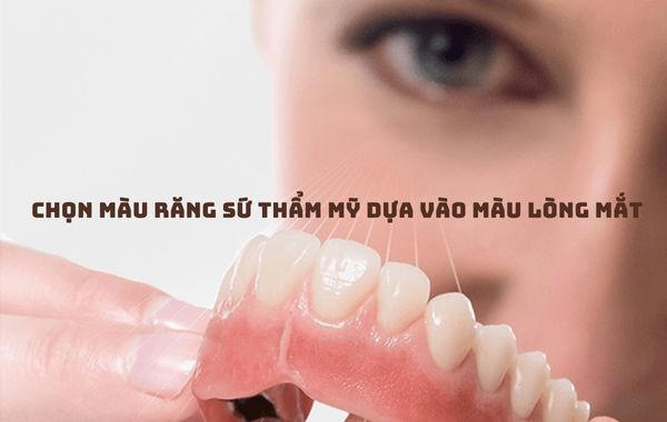 Có thể chọn màu răng sứ thẩm mỹ bằng cách dựa vào màu của lòng mắt Có thể chọn màu răng sứ thẩm mỹ bằng cách dựa vào màu của lòng mắt