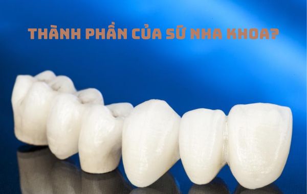 Thành phần của sứ nha khoa gồm những gì?