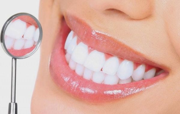 Phục hình răng bằng phương pháp bọc sứ