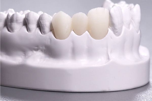 Răng sứ Zirconia là gì?